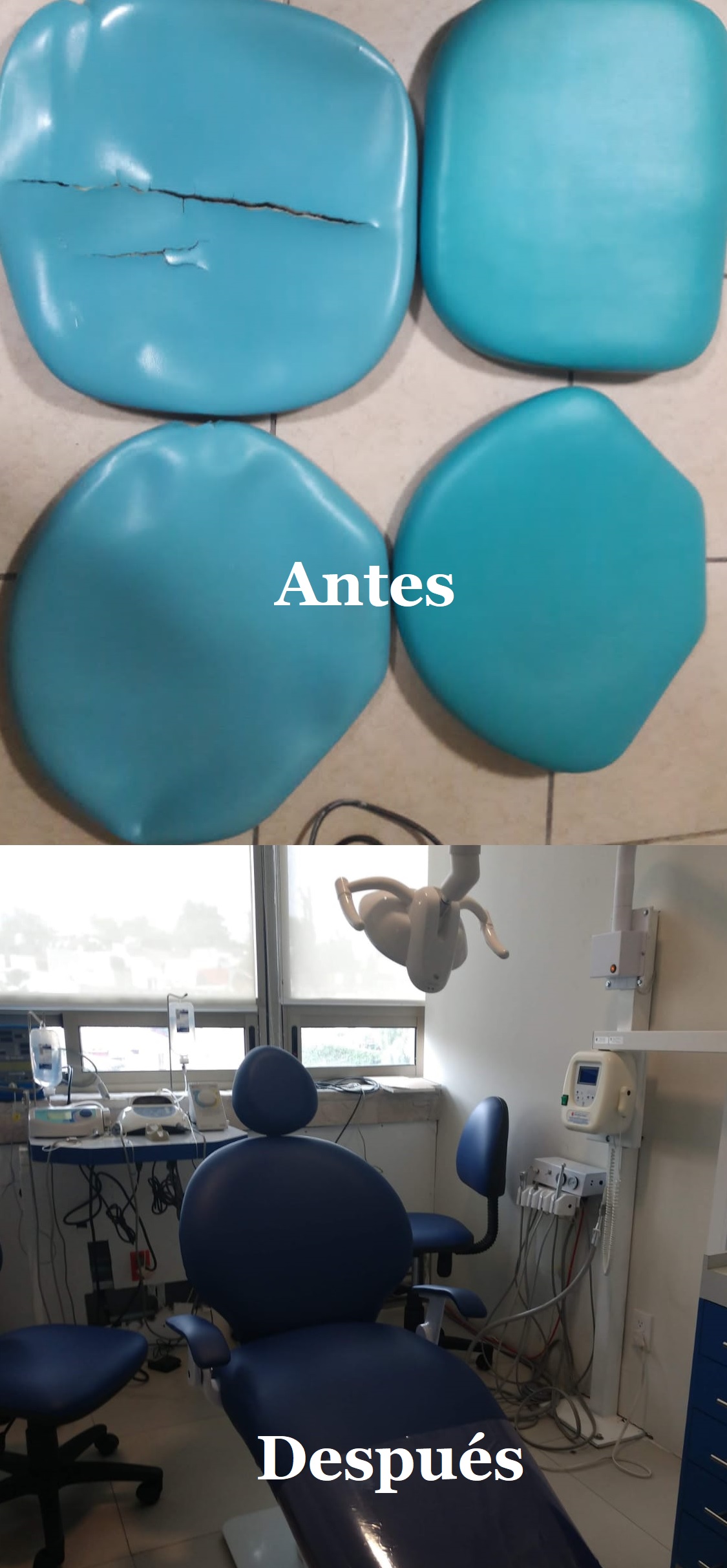 Cambio de tapiz de unidad dental