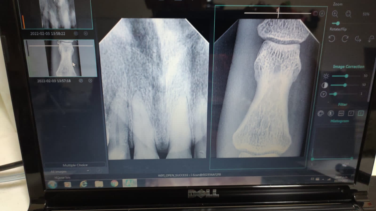 Radiovisógrafo imágenes